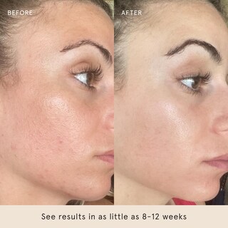 Foto 5 | Foto 5 | Almohadillas Tonificantes Exfoliantes Para Rostro Descubierto Con Ácido Glicólico 60 Unidades - Venta Internacional.