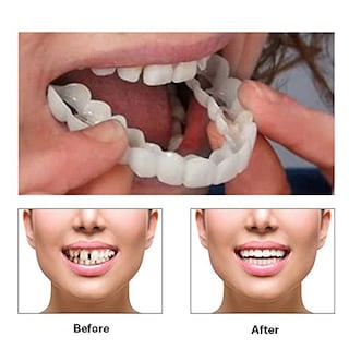 Foto 3 | Foto 3 | Dos Pares De Dentaduras Ajustables Para Hombres Y Mujeres - Venta Internacional.