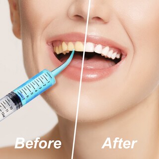 Foto 7 | Foto 7 | Jeringa Dental Zhengmy De 12 Ml Desechable Punta Curva Paquete De 100 - Venta Internacional.