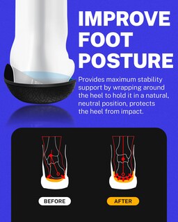 Foto 5 | Foto 5 | Plantillas Walkhero Para Fascitis Plantar Alivio Del Dolor Arco Alto - Venta Internacional.