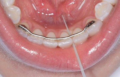 Foto 7 | Foto 7 | Dental Picks Opalpix  10 Paquetes (320 Púas)  Goma De Mascar Blanda Para El Cuidado Bucal - Venta Internacional.