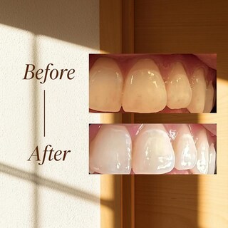 Foto 5 | Foto 5 | La Pasta De Dientes Boka Nano Hydroxyapatite Remineraliza Los Dientes Sensibles - Venta Internacional.