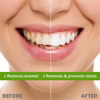 Foto 7 | Foto 7 | Pasta De Dientes Rembrandt Deeply White + Peroxide Whitening 100mlx2 - Venta Internacional.