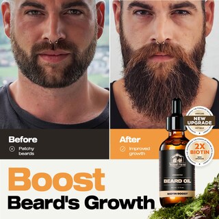Foto 5 | Foto 5 | Aceite Para Barba Waking Forest Biotin Growth Con Vitamina E 60 Ml Sin Perfume - Venta Internacional.