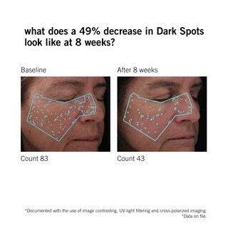 Foto 5 | Foto 5 | Sérum Neova Smartskincare Dna Total Repair De 30 Ml Para El Daño Solar - Venta Internacional.