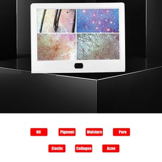 Foto 3 | Foto 3 | Detector De Cuero Cabelludo Fokh De 13 Pulgadas Con Lente 50x/200x Recargable - Venta Internacional.