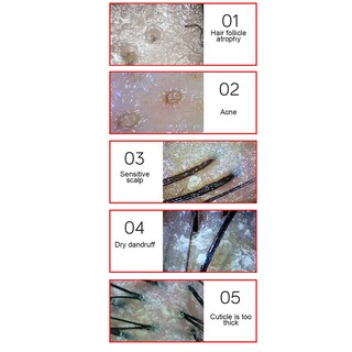 Foto 4 | Foto 4 | Detector De Cuero Cabelludo Fokh De 13 Pulgadas Con Lente 50x/200x Recargable - Venta Internacional.