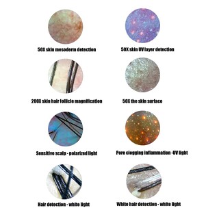 Foto 5 | Foto 5 | Detector De Cuero Cabelludo Fokh De 13 Pulgadas Con Lente 50x/200x Recargable - Venta Internacional.