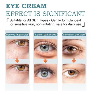 Foto 6 | Foto 6 | Crema De Ojos Guvada Retinol Ácido Hialurónico Reafirmante 20g - Venta Internacional.