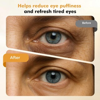 Foto 3 | Foto 3 | Masajeador De Ojos Para Frío Y Calor Multimodo Redlook Depuffing Wand - Venta Internacional.