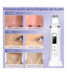 Foto 4 | Foto 4 | Espátula Ultrasónica Limpiador Ultrasónico Facial Con 3 Modos 400mah Limpiador Ultrasonido Facial Con Pantalla