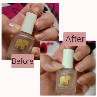 Foto 6 | Foto 6 | Fortalecedor De Uñas Ella+mila First Aid Kiss Con Vitamina E 13 Ml - Venta Internacional.