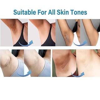 Foto 4 | Foto 4 | Crema Blanqueadora De Piel Ceavo Para Áreas Íntimas Del Cuerpo 50 Ml - Venta Internacional.