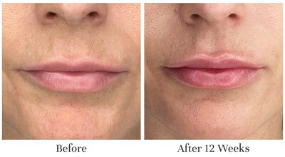 Foto 3 | Foto 3 | Tratamiento Labial City Beauty City Lips Night Oil Antiedad - Venta Internacional.