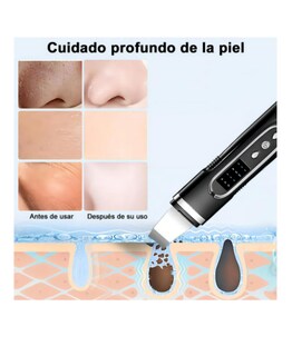 Foto 3 | Foto 3 | Limpiador Facial Ultrasónico Negro Carga Usb 4 Modos Profundos