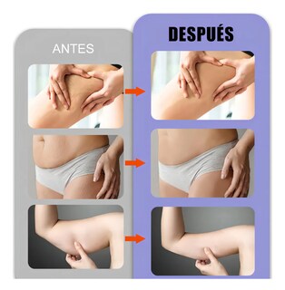Foto 3 | Foto 3 | Masajeador Facial Portátil Para Belleza 4 Luces 4 En 1