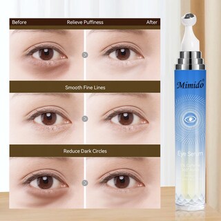 Foto 3 | Foto 3 | Crema Para Ojos Mimido Con Cafeína 20 Ml Reduce La Hinchazón De Las Ojeras - Venta Internacional.
