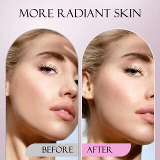 Foto 3 | Foto 3 | Maquinilla De Afeitar Dermaplane Cevek Con Tecnología Sonic Edge Con 8 Cuchillas - Venta Internacional.