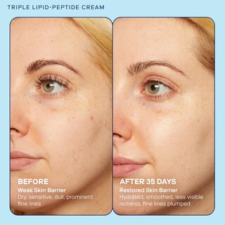 Foto 3 | Foto 3 | Set De Crema Skincare Skinfix Barrier+ De Triple Lípido-péptido - Venta Internacional.
