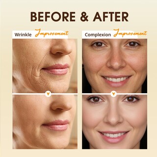 Foto 2 | Foto 2 | Sérum De Colágeno Con Retinol Biysber 50 Ml Hidratante Antienvejecimiento - Venta Internacional.