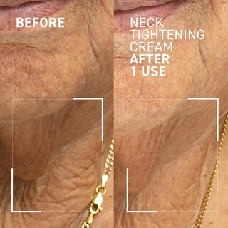 Foto 2 | Foto 2 | Crema Para Reafirmar El Cuello Dr. Brandt Needles No More  50 G X 2 - Venta Internacional.