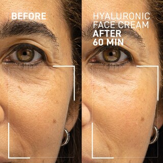 Foto 2 | Foto 2 | Crema Facial Dr. Brandt Needles No More Hyaluronic 50 Ml X2 - Venta Internacional.