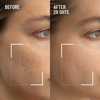 Foto 2 | Foto 2 | Exfoliante Facial Dr. Brandt  Microdermoabrasión  60 G  Paquete De 2 - Venta Internacional.