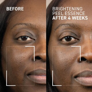 Foto 4 | Foto 4 | Esencia Exfoliante Iluminadora Dr. Brandt Dr. B Lab  100 Ml - Venta Internacional.