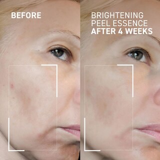 Foto 3 | Foto 3 | Esencia Exfoliante Iluminadora Dr. Brandt Dr. B Lab  100 Ml X 2 - Venta Internacional.