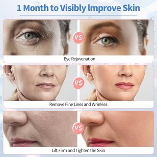 Foto 7 | Foto 7 | Dispositivo Facial Texet Microcurrent Con Fototerapia 6 En 1 - Venta Internacional.