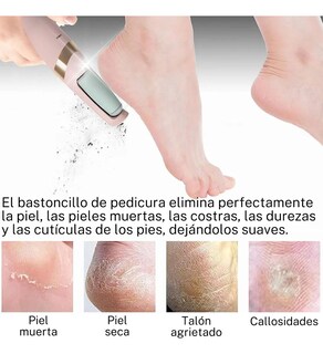 Foto 2 | Foto 2 | ''aparato De Pedicura Eléctrico Con Papel De Lija Para Pies Rosa ''