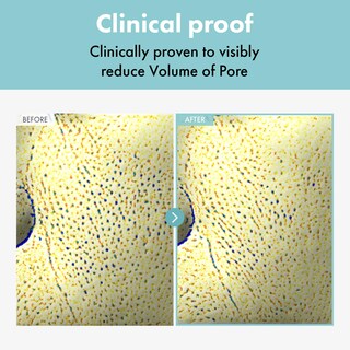 Foto 2 | Foto 2 | Crema Refinadora De Poros Tosowoong Extractor De Poros 50 G Para Piel Grasa - Venta Internacional.