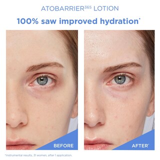 Foto 4 | Foto 4 | Crema Hidratante Aestura Atobarrier365 Lightweight 90 Ml Con Ceramidas - Venta Internacional.