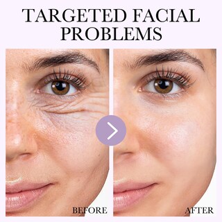 Foto 4 | Foto 4 | Mascarilla Facial De Hidrogel Orlaskin Deep Bio-collagen 204 Ml X6 - Venta Internacional.