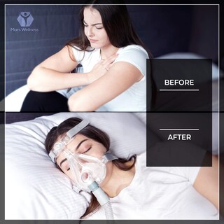 Foto 2 | Foto 2 | Manguera Cpap Mars Wellness Universal De 1 8 M Y 19 Mm De Diámetro (paquete De 2) - Venta Internacional.