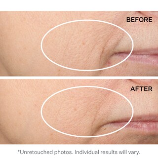 Foto 4 | Foto 4 | Crema Facial Strivectin Multi-action Restauradora 50 Ml - Venta Internacional.