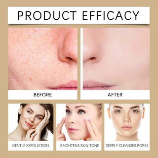 Foto 6 | Foto 6 | Exfoliante De Arroz Blando 2 Unidades Blanco Y Negro Para Todo Tipo De Piel - Venta Internacional.