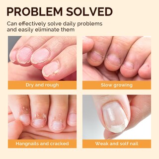 Foto 2 | Foto 2 | Set De Bolígrafos Con Aceite Para Cutículas Melodysusie Hidratante De Uñas 15 Unidades - Venta Internacional.