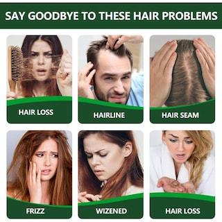 Foto 4 | Foto 4 | Pack De 2 Aceites De Romero Para Estimular El Crecimiento Y Nutrir El Cabello 30ml