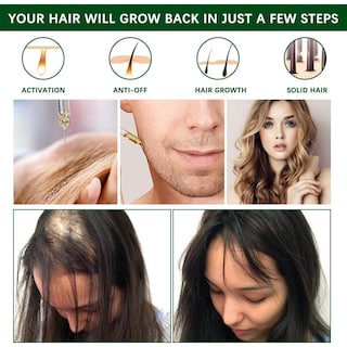 Foto 6 | Foto 6 | Pack De 2 Aceites De Romero Para Estimular El Crecimiento Y Nutrir El Cabello 30ml