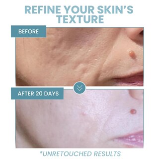 Foto 6 | Foto 6 | Sérum De Niacinamida Eva Naturals 5% Con Ácido Hialurónico Y Aloe Para Reducción De Arrugas Y Acné