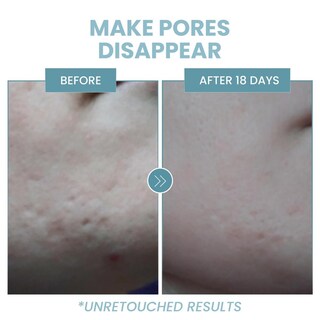 Foto 8 | Foto 8 | Sérum De Niacinamida Eva Naturals 5% Con Ácido Hialurónico Y Aloe Para Reducción De Arrugas Y Acné