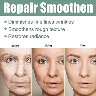 Foto 5 | Foto 5 | Suero Antiaging Ren Skincare Avanzado Para Una Piel Radiante