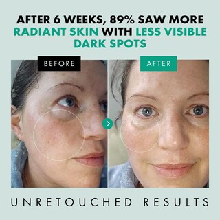 Foto 5 | Foto 5 | Suero Antienvejecimiento Vegano De Niacinamida Con Zinc Y Ácido Hialurónico Para Reducir Arrugas Y M