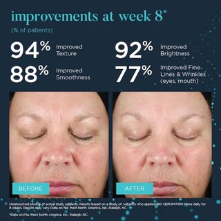 Foto 4 | Foto 4 | Suero Hidratante Anti-envejecimiento Neocutis Bio Serum Sin Fragancia 30ml