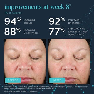 Foto 7 | Foto 7 | Suero Hidratante Anti-envejecimiento Neocutis Bio Serum Sin Fragancia 30ml