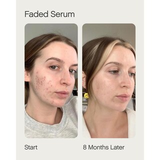 Foto 4 | Foto 4 | Suero Aclarador Faded Topicals Kit De Inicio Mancha Oscura