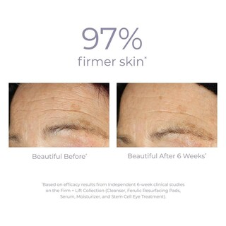 Foto 6 | Foto 6 | Sérum Concentrado Derma-e Ultra Lift Dmae Unisex 1 Oz