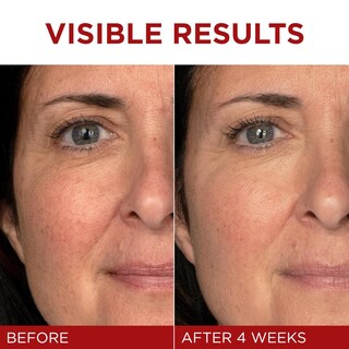 Foto 8 | Foto 8 | Crema Hidratante Facial L’oreal Paris Revitalift Sin Fragancia Con Pro Retinol Ácido Hialurónico Y