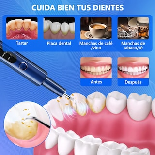 Foto 5 | Foto 5 | Kit Belug De Limpieza Para Remover Sarro Con Ultrasonidos Azul